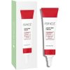 Sinoz Acne Free Cream 15ml